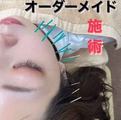 美容鍼灸サロン ハリナチュレ 沖縄那覇店